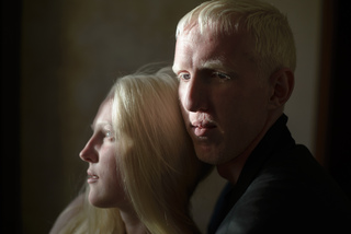 Albino family