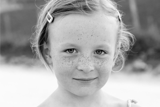 Freckled girl