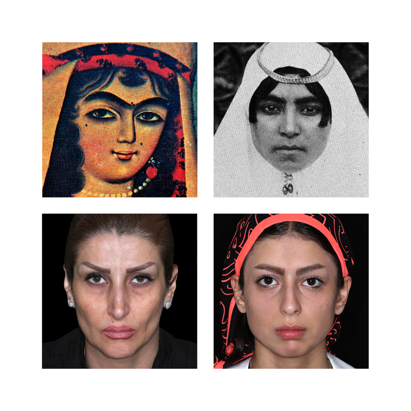 The aesthetical icon of iranian women's face: old and new