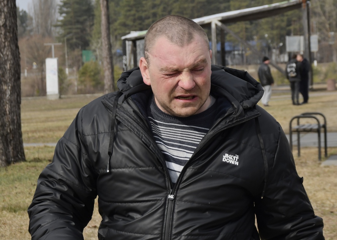 Перша травма