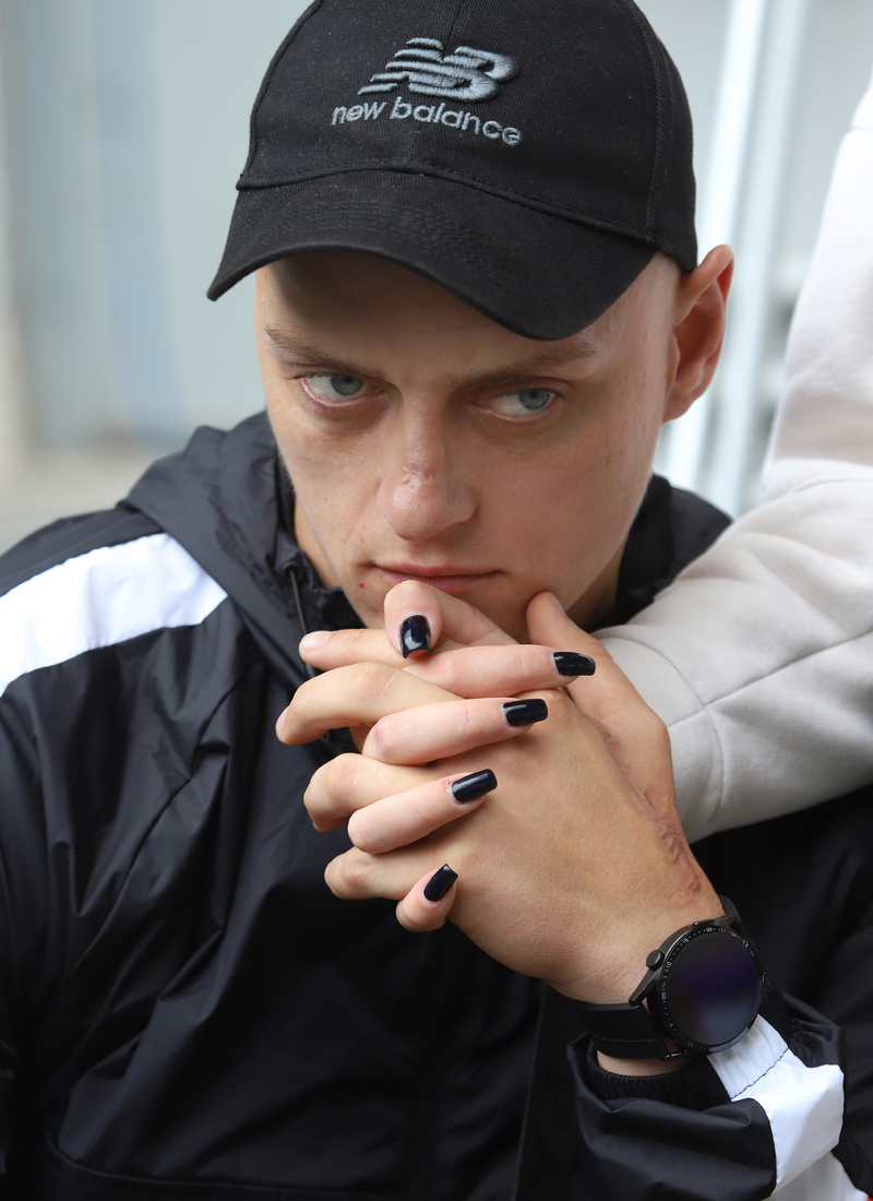 After a serious inijuri..